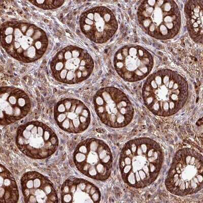 Immunohistochemistry-Paraffin: LSM12 Antibody [NBP2-14205]
