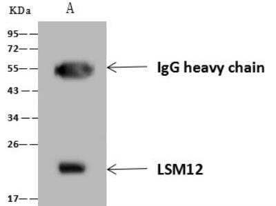 Immunoprecipitation: LSM12 Antibody [NBP3-12550]