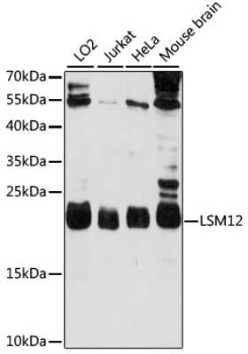 Western Blot: LSM12 AntibodyAzide and BSA Free [NBP3-04499]