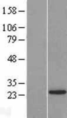 Western Blot: LSM12 Overexpression Lysate [NBL1-12723]