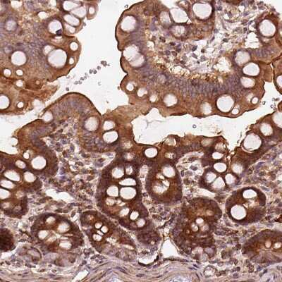 Immunohistochemistry-Paraffin: LSM14A Antibody [NBP1-88473]