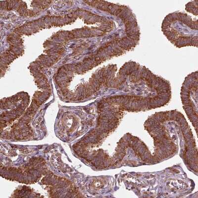 Immunohistochemistry-Paraffin: LSM14A Antibody [NBP1-88473]