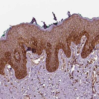 Immunohistochemistry-Paraffin: LSM14A Antibody [NBP1-88473]