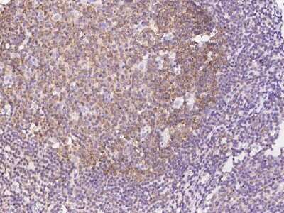 Immunohistochemistry-Paraffin: LSM14A Antibody [NBP2-99157]