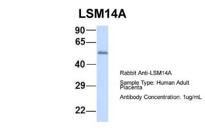 Western Blot: LSM14A Antibody [NBP1-56588]