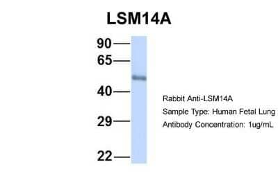 Western Blot: LSM14A Antibody [NBP1-56784]