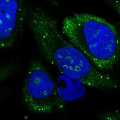 Immunocytochemistry/ Immunofluorescence: LSM14B Antibody [NBP2-14508]