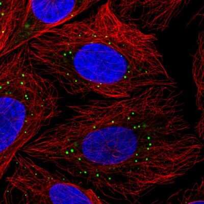 Immunocytochemistry/ Immunofluorescence: LSM14B Antibody [NBP2-56828]