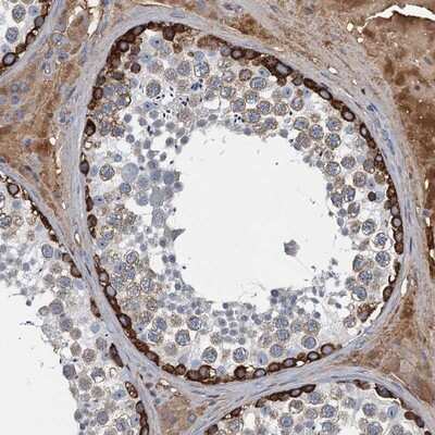 Immunohistochemistry-Paraffin: LSM14B Antibody [NBP2-14508]