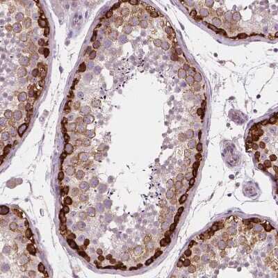 Immunohistochemistry-Paraffin: LSM14B Antibody [NBP2-56828]