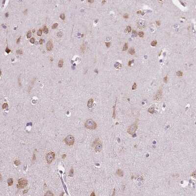 Immunohistochemistry-Paraffin: LSM14B Antibody [NBP2-56828]