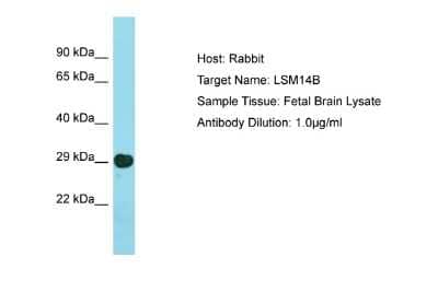 Western Blot: LSM14B Antibody [NBP2-87753]