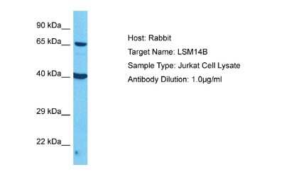 Western Blot: LSM14B Antibody [NBP2-87754]