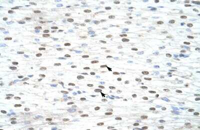 Immunohistochemistry-Paraffin: LSM2 Antibody [NBP1-57504]