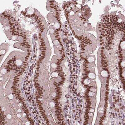Immunohistochemistry-Paraffin: LSM2 Antibody [NBP2-38093]