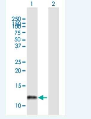 Western Blot: LSM2 Antibody [H00057819-B01P-50ug]