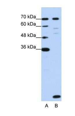 Western Blot: LSM2 Antibody [NBP1-57504]