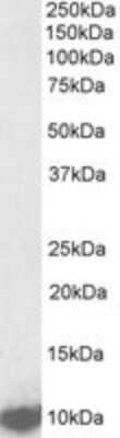 Western Blot: LSM2 Antibody [NBP2-26136]