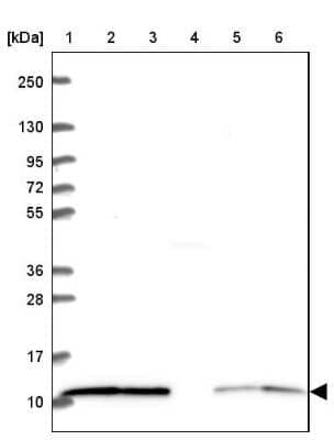 Western Blot: LSM2 Antibody [NBP2-38093]