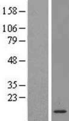 Western Blot: LSM2 Overexpression Lysate [NBL1-12725]