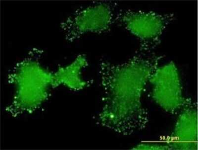 Immunocytochemistry/ Immunofluorescence: LSM3 Antibody (4C8-2D10) [H00027258-M01]