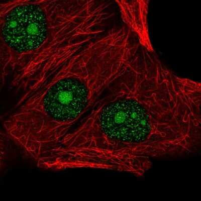 Immunocytochemistry/ Immunofluorescence: LSM3 Antibody [NBP2-14206]