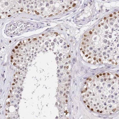 Immunohistochemistry-Paraffin: LSM3 Antibody [NBP2-14206]