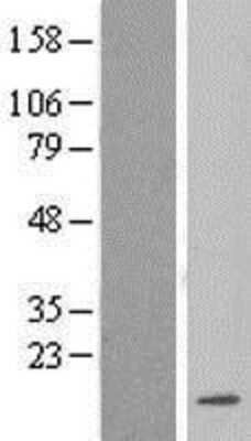 Western Blot: LSM3 Overexpression Lysate [NBL1-12726]