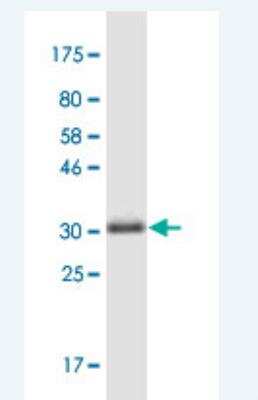 Western Blot: LSM4 Antibody (8A10) [H00025804-M01-100ug]