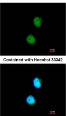 Immunocytochemistry/ Immunofluorescence: LSM4 Antibody [NBP2-17182]