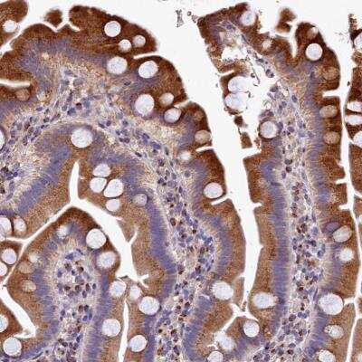 Immunohistochemistry-Paraffin: LSM4 Antibody [NBP1-86846]