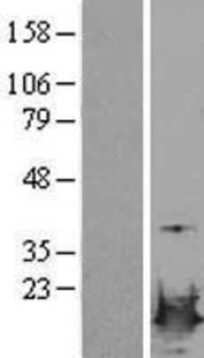 Western Blot: LSM4 Overexpression Lysate [NBL1-12727]