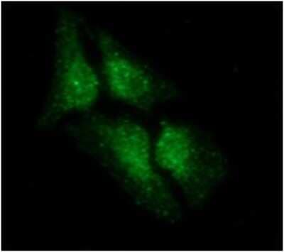 Immunocytochemistry/ Immunofluorescence: LSM5 Antibody (25F8) - BSA Free [NBP2-59399]
