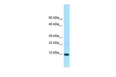 Western Blot: LSM5 Antibody [NBP2-85236]