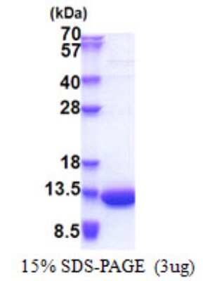 SDS-PAGE: Recombinant Human LSM5 His Protein [NBP2-23202]