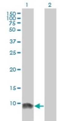 Western Blot: LSM6 Antibody (4B5-1B10) [H00011157-M01]