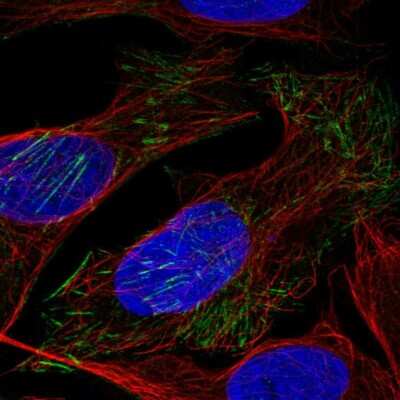 Immunocytochemistry/ Immunofluorescence: LSM6 Antibody [NBP1-92083]