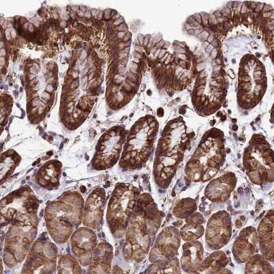 Immunohistochemistry-Paraffin: LSM6 Antibody [NBP1-92083]