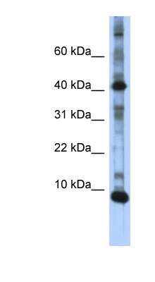 Western Blot: LSM6 Antibody [NBP1-57318]