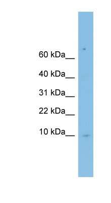 Western Blot: LSM6 Antibody [NBP1-57519]