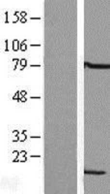 Western Blot: LSM6 Overexpression Lysate [NBL1-12729]