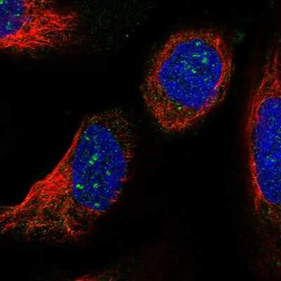 Immunocytochemistry/ Immunofluorescence: LSM7 Antibody [NBP1-92084]