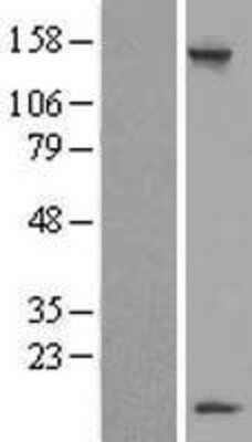 Western Blot: LSM7 Overexpression Lysate [NBL1-12730]