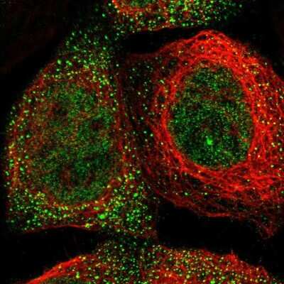 Immunocytochemistry/ Immunofluorescence: LSM8 Antibody [NBP1-92085]