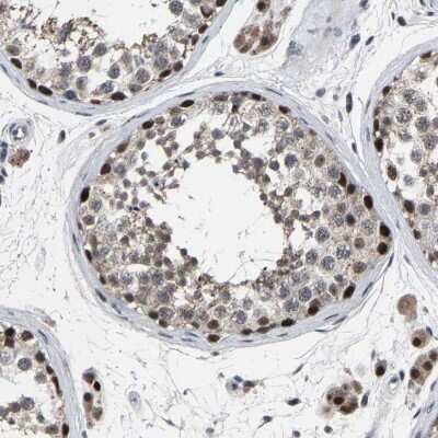 Immunohistochemistry-Paraffin: LSM8 Antibody [NBP1-92085]