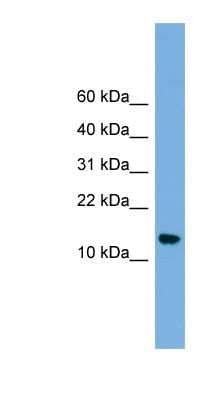 Western Blot: LSM8 Antibody [NBP1-57082]