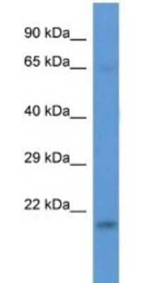 Western Blot: LSMD1 Antibody [NBP1-74258]