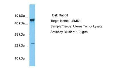 Western Blot: LSMD1 Antibody [NBP2-84149]