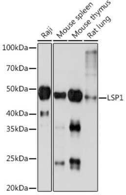 Western Blot: LSP1 Antibody (4U10N5) [NBP3-16171]