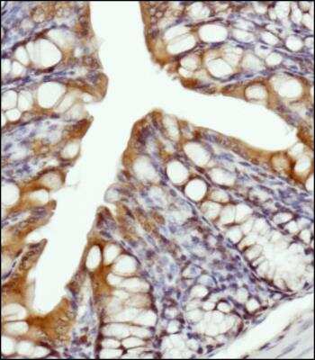 Immunohistochemistry-Paraffin: LSP1 Antibody - BSA Free [NBP1-74048]
